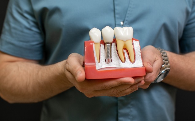 Uszkodzenie implantu zęba – jak wygląda leczenie?