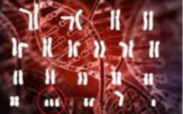 Radość, która nie przemija – czego seniorzy z zespołem Downa mogą nas nauczyć o szczęściu?