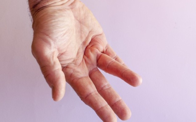 Wykrzywienie palców u seniorów – przyczyny, objawy i możliwości leczenia